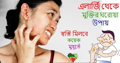 এলার্জি দূর করার উপায়