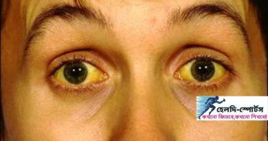 জন্ডিসের লক্ষণ