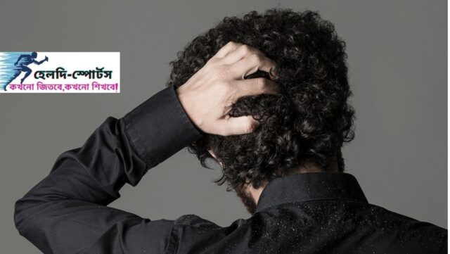 খুশকি দূর করার উপায়