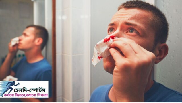 নাক দিয়ে রক্ত পড়ার কারণ