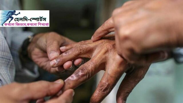 কুষ্ঠ রোগের লক্ষণ