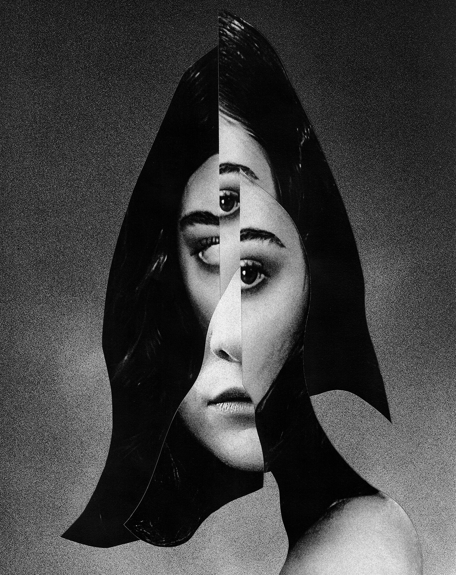 What Does a Crown on a Tooth Look Like