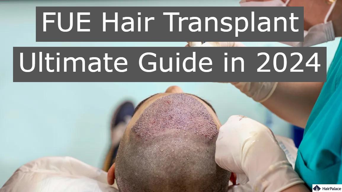 Uk Hair Transplants